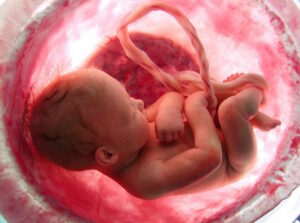 Diagnosi prenatale dei disturbi genetici: un supporto fondamentale per le future mamme